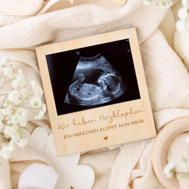 Ultrasound Pregnancy Announcem - đánh giá và giá Photo Booth Frame